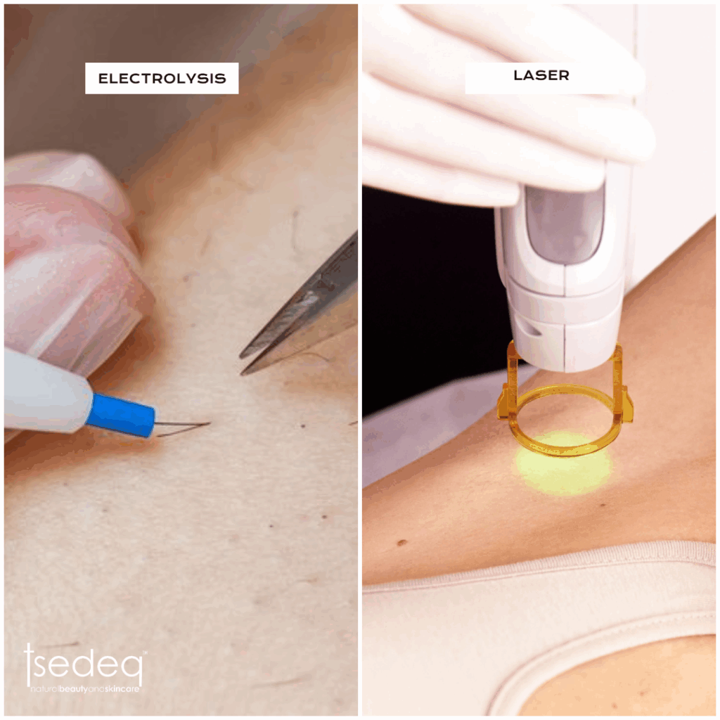 Electrolysis versus laser: which one is right for you?
In the quest for long term, hair-free skin, two treatments have dominated the entire conversation:
Electrolysis and laser hair removal.
As advancements in technology continue to evolve, it becomes increasingly important to understand the differences, efficacy and permanence of these two modalities to make an informed decision about which one would be best suited for you.