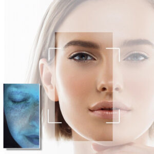 SKIN CONSULTATION IN CLINIC 45 minutes